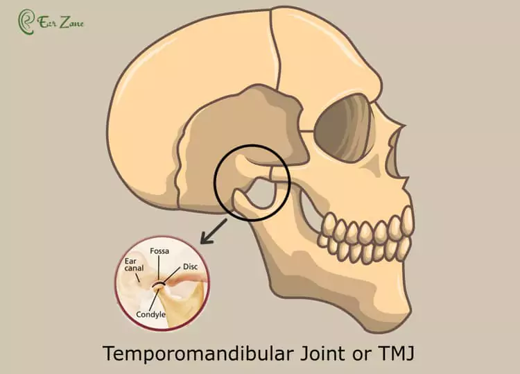 Image of temporomandibular joint or TMJ. Blog on TMJ cause Tinnitus.