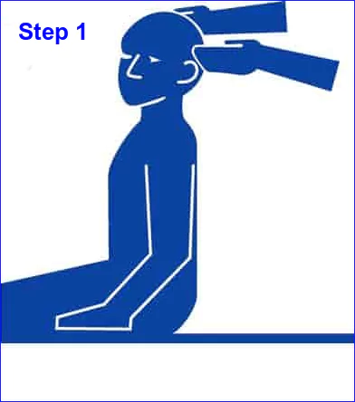 Blog image: Epley Maneuver step 1 by ear-zone.com