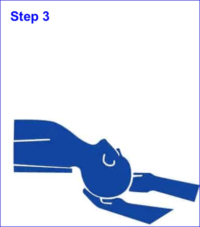 Blog image: Epley Maneuver step 3 by ear-zone.com