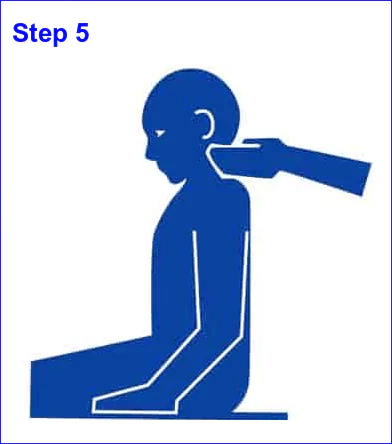 Blog image: Epley Maneuver step 5 by ear-zone.com